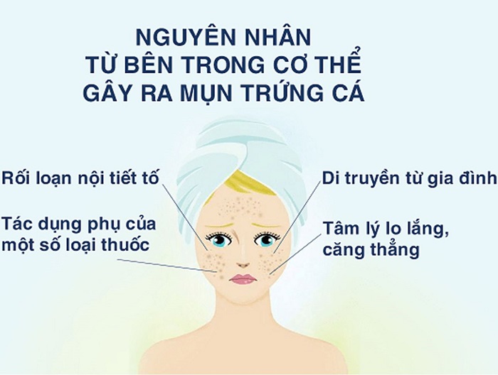 nguyen-nhan-xuat-hien-mun-trung-ca-va-cach-dieu-tri-sanfiecosmetic